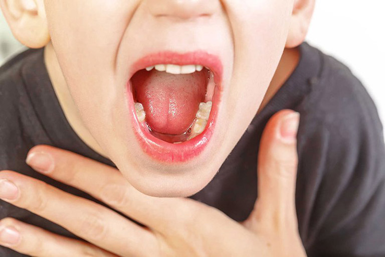 viêm họng liên cầu khuẩn là gì