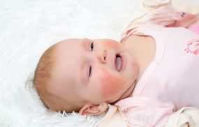 Chàm đỏ ở trẻ sơ sinh và thông tin cần biết