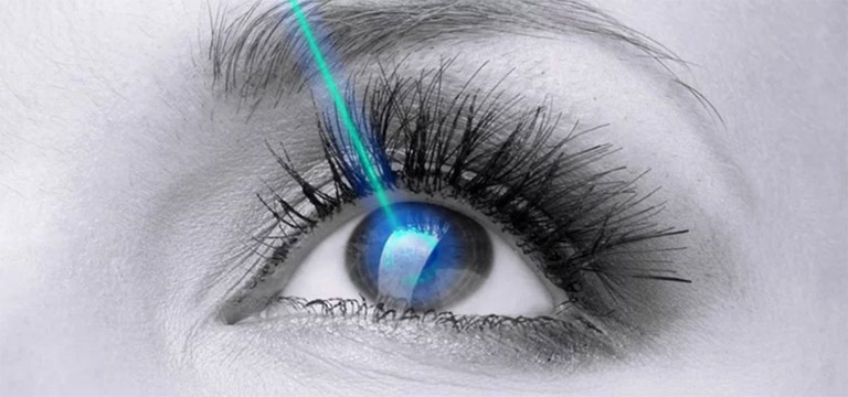 mổ mắt công nghệ lasik ở hà nội