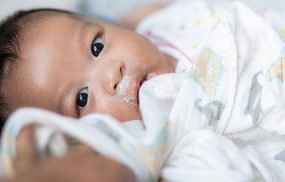 Nôn trớ ở trẻ sơ sinh và những thông tin cần biết