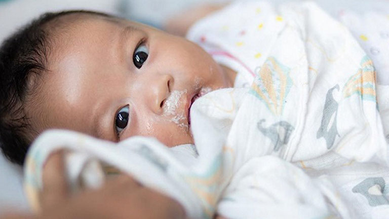 Nôn trớ ở trẻ sơ sinh và những thông tin cần biết 