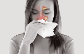 Những điều cần biết về polyp mũi