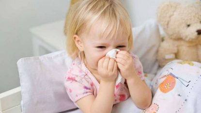 Polyp mũi ở trẻ em là một dạng u lành tính
