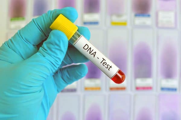Những điều cần biết khi xét nghiệm ADN làm giấy khai sinh