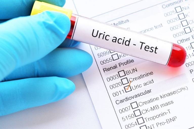 Chỉ số acid uric bao nhiêu là bị gout