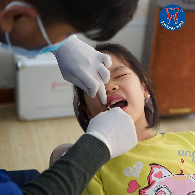 Địa chỉ khám nhổ răng sữa cho bé tại Hà Nội