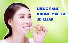 Niềng răng 3D Clear Aligner