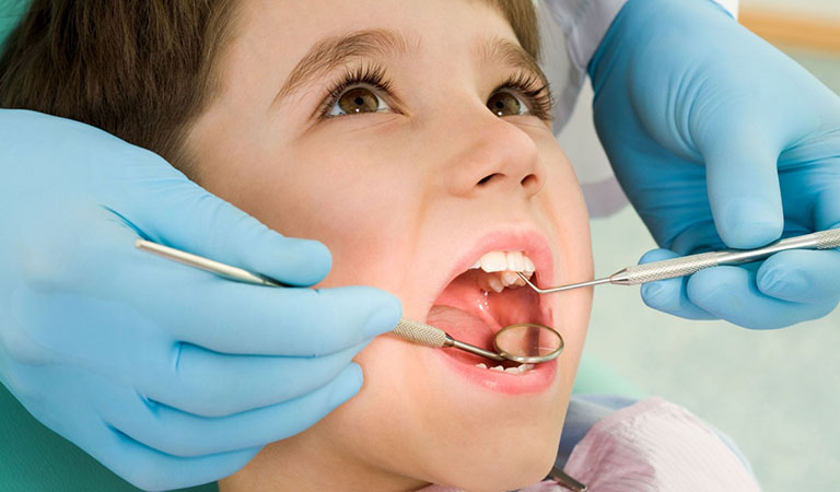 Những lợi ích khi tiến hành niềng răng sớm cho trẻ