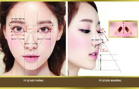 Nâng mũi cấu trúc 4D có mức độ tương thích với cơ thể người cao, hiếm khi xảy ra trường hợp bài xích do sử dụng sụn tự thân