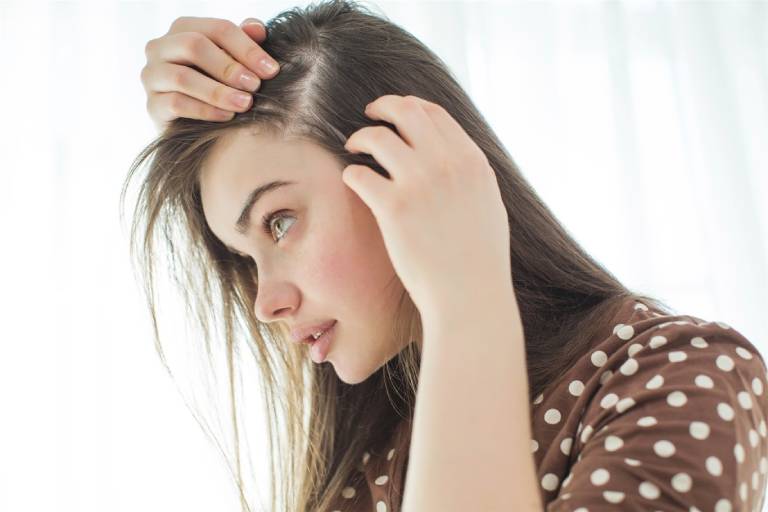 Rụng tóc do rối loạn nội tiết tố