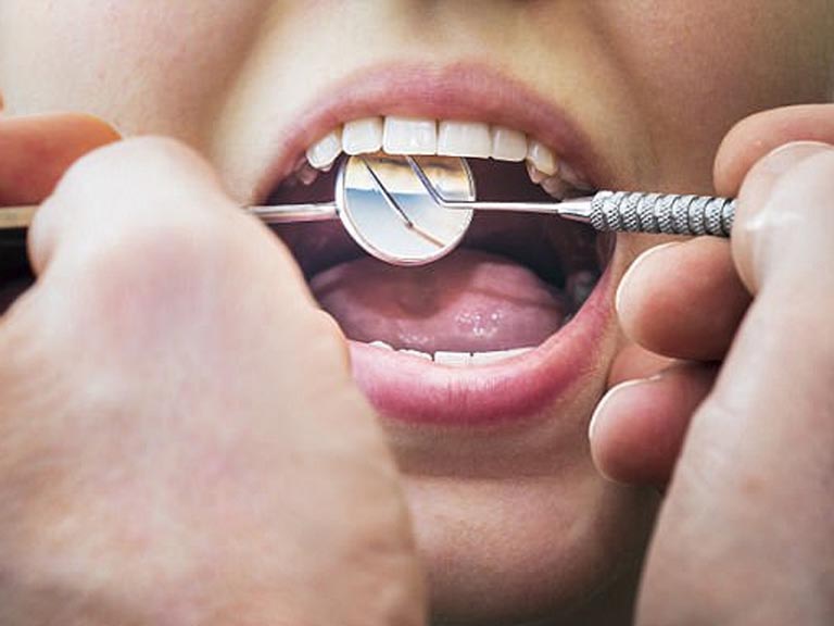 Nên đi khám và điều trị các vấn đề về răng miệng sớm để tránh gặp biến chứng