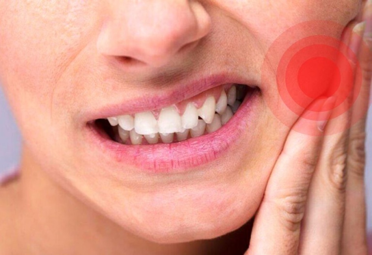 Răng hàm bị sâu đau nhức