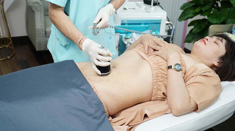 spa trị rạn da sau sinh tại TPHCM uy tín